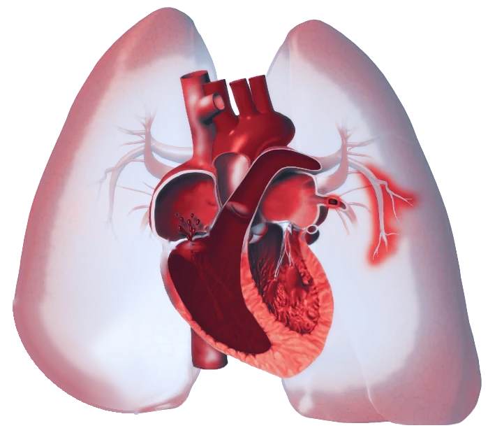 Illustration of translucent lungs with the heart and pulmonary arteries in front